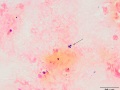 Rhodococcus equi (gram)
