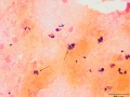 Rhodococcus equi (gram)