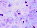Rhodococcus equi