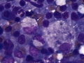 Neorickettsia