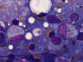Neorickettsia