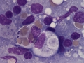 Neorickettsia