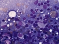 Neorickettsia