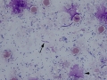 Mixed oral bacteria