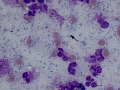 Mixed oral bacteria
