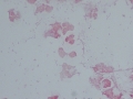 Mixed oral bacteria