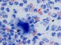 Mixed oral bacteria