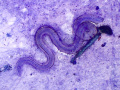 Soil nematode
