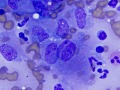 Mycobacteria (DQ)