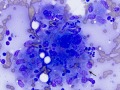 Mycobacteria (DQ)