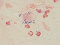 Streptococcus zooepidemicus (gram)