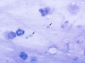 Pneumocystis