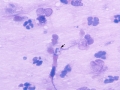 Pneumocystis