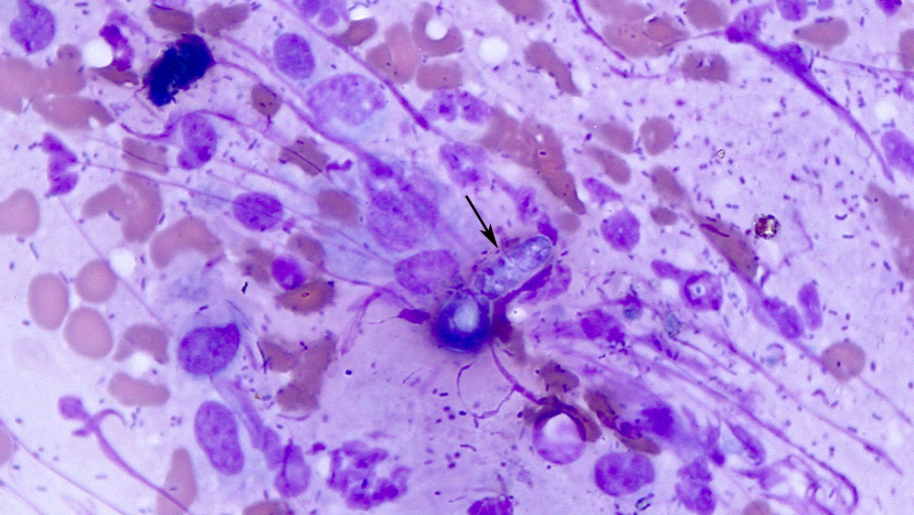 Infectious agents (cytology) | eClinpath