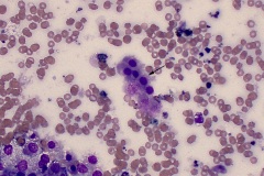 Kidney