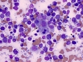 Lymphoma (cat)