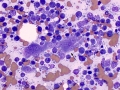 Lymphoma & giant cell (cat)