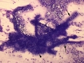 Glomeruli & tubules