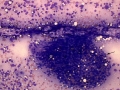 Glomeruli & tubules