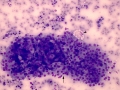Suspect carcinoma (cat)