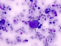 Suspect carcinoma (cat)