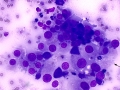 Suspect carcinoma (cat)