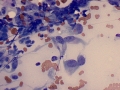 Fibrosarcoma (cat)