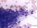 GIST or smooth muscle tumor (dog)