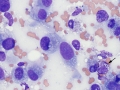 Sarcoma (cat)