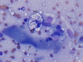 Hemangiosarcoma (horse)