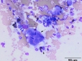 Giant cell tumor of soft parts (horse)