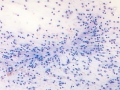 Soft tissue sarcoma (dog)