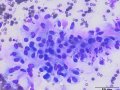 Soft tissue sarcoma (dog, DQ)