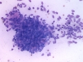 Sarcoma (dog)