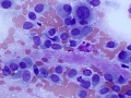 Osteosarcoma (dog)