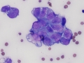 Hemangiosarcoma (horse)