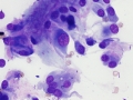 Soft tissue sarcoma (DQ, dog)