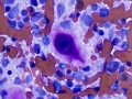 Osteosarcoma (dog)