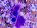 Osteosarcoma (dog)