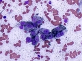Melanoma (dog)