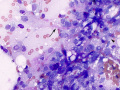 Suspect liposarcoma (dog)