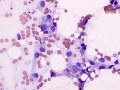 Suspect liposarcoma (dog)