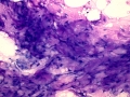 Myxoid tumor (dog)