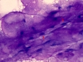 Myxoid tumor (dog)