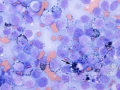 Melanoma (dog)