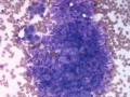 Leiomyosarcoma (dog)