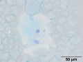 Mucin-producing sarcoma (dog, alcian blue)