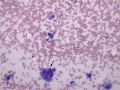 Sarcoma with giant cells (cat)