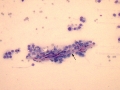 Soft tissue sarcoma (dog)