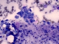 Soft tissue sarcoma (dog)